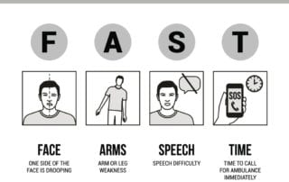 Stroke information