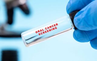oral cancer